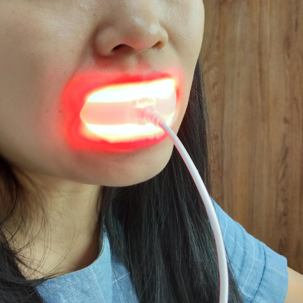 Clinic Red Laser Oral Therapy  - Healing Wellness reseña y precio