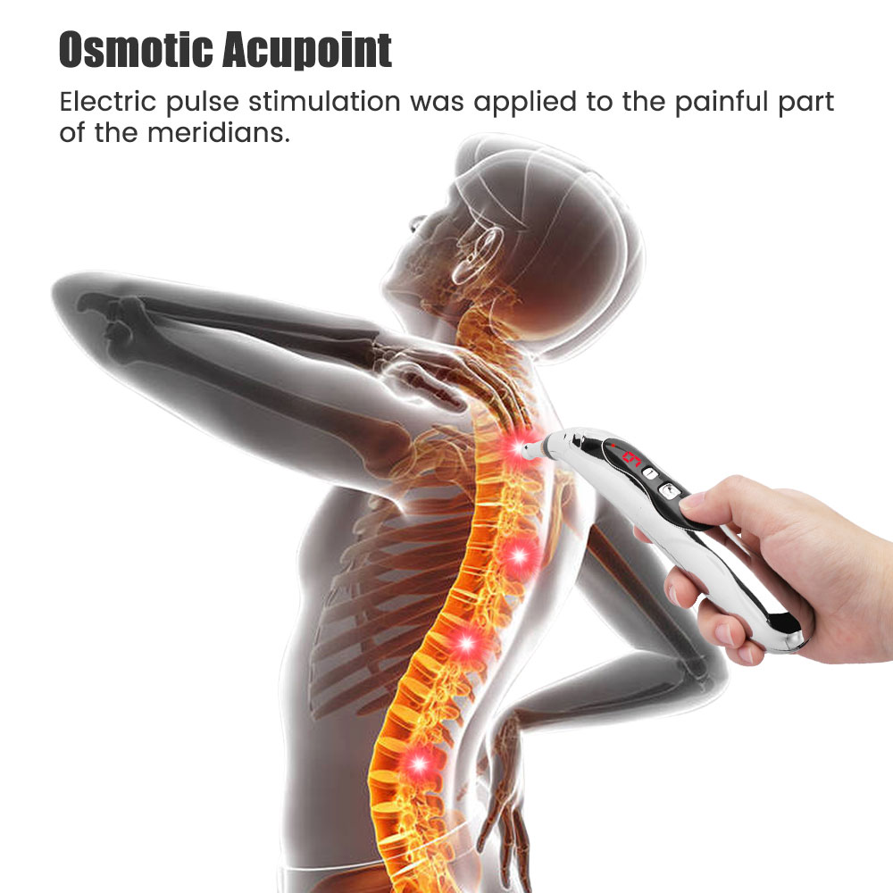 Electronic Acupuncture Pen The - Healing Wellness reseña y precio